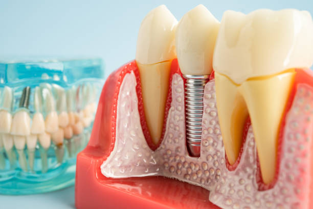 Professional  Dental Services in Warm Mineral Springs, FL